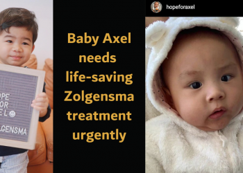 We helped Devdan walk. Now, let’s help baby Axel.